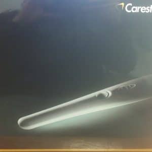 Carestream CS 1200 Intraoral Camera System