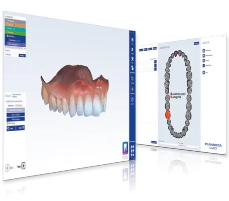Planmeca PlanMill 60 S Dental Milling Unit - New 4