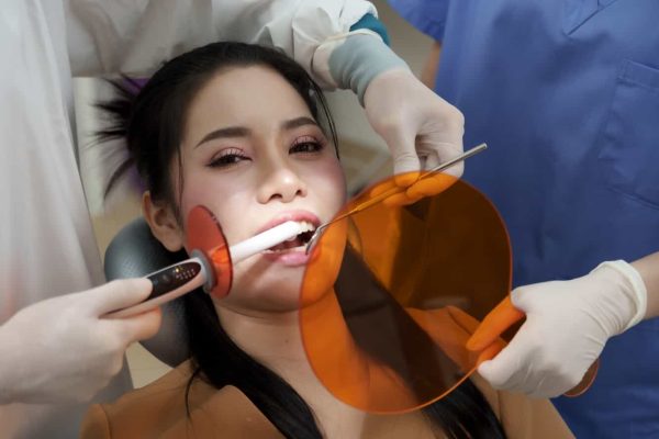 The Ultimate Review: Top 10 Dental Curing Lights Compared 1 Dental Curing Lights