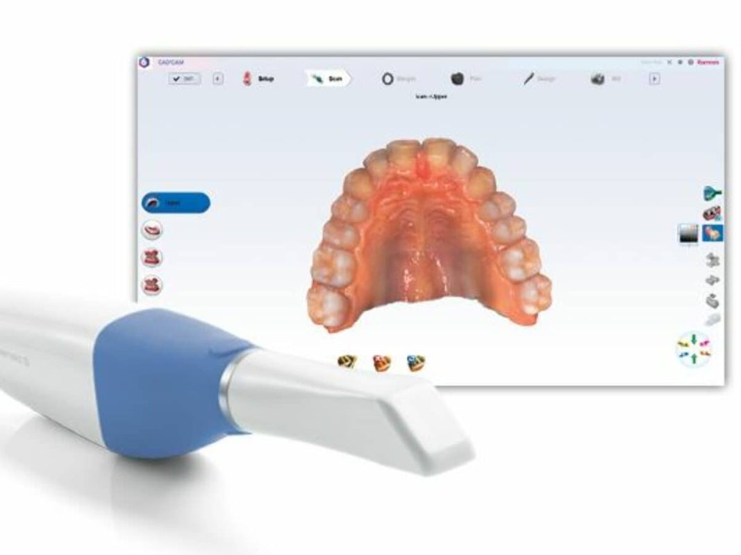 Scanner Intra-oral Planmeca Emerald S – CAD/CAM – Occasion – Démo